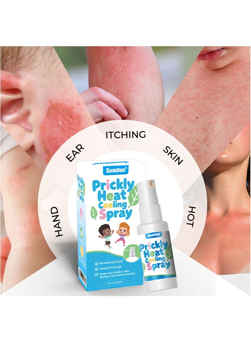 سوميفون عبوة من قطعتين من بخاخ تبريد الحرارة الشائكة يخفف الحرارة الشائكة وتهيج الجلد حماية مضادة للبكتيريا للبشرة يهدئ الحكة الناتجة عن لدغات الحشرات يوفر الراحة وتخفيف الحكة (30 مل + 30 مل) - Image 2